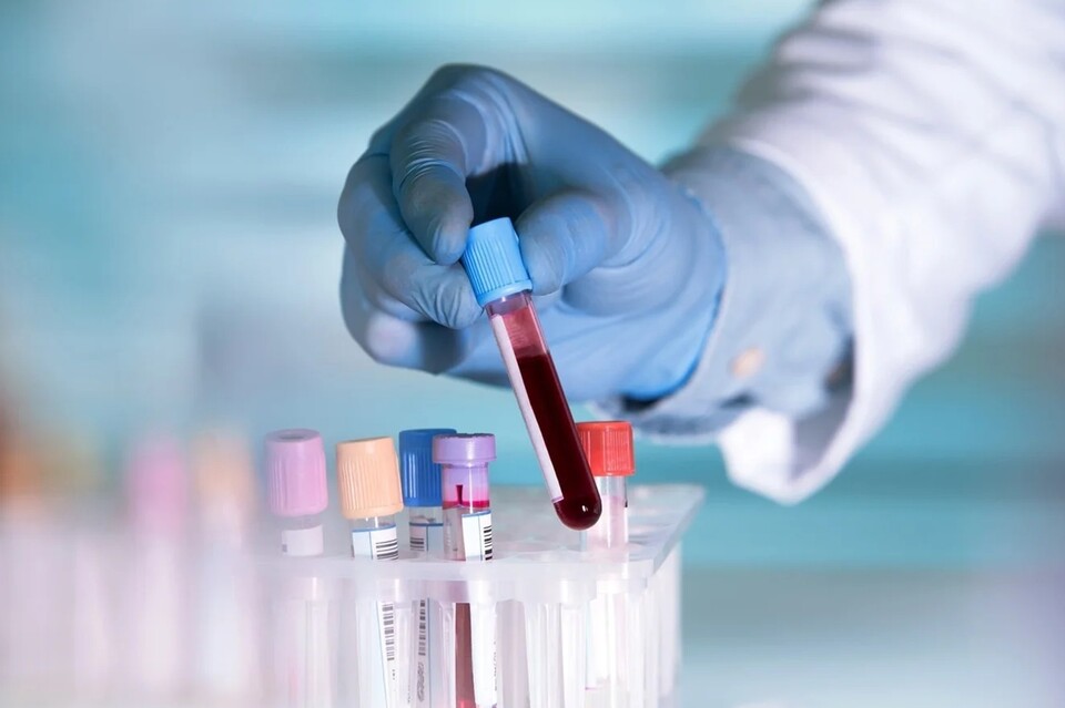 기사와 관련이 없는 혈액 채취 진단 관련 참고 이미지. [셔터스톡 제공]