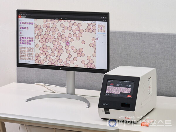 노을 AI 기반 말라리아 솔루션(miLab MAL) 이미지. [노을 제공]