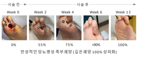 [로킷헬스케어 제공]